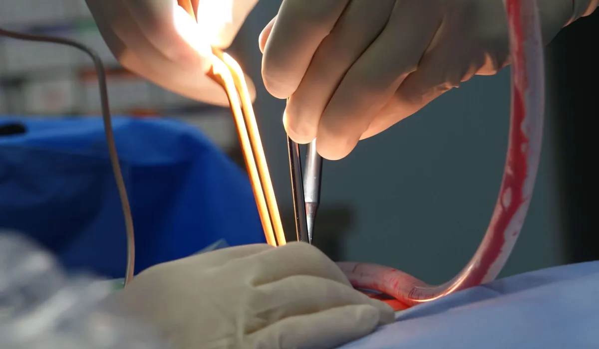 Cirurgia Geral