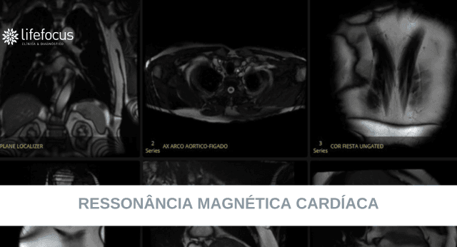Ressonância Magnética Cardíaca – Lifefocus Estefânia