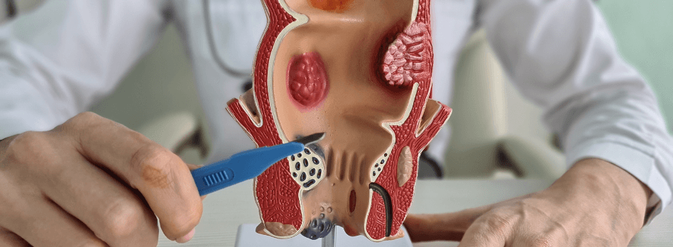 Proctologia