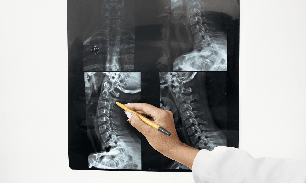Ressonância Magnética da Coluna Cervical