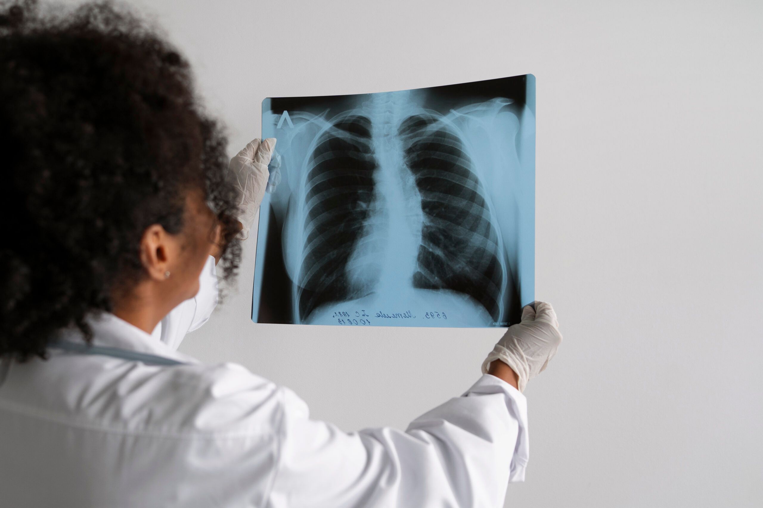 Estudo de Difusão Pulmonar (DLCO)