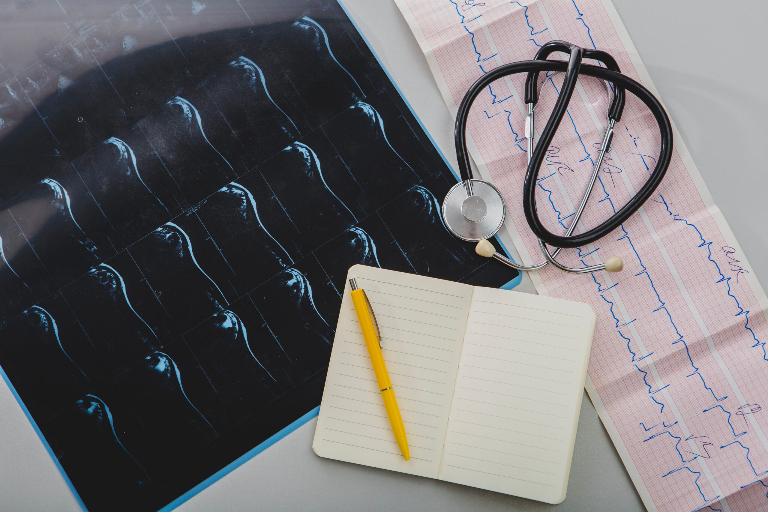 CTG (Cardiotocografia)