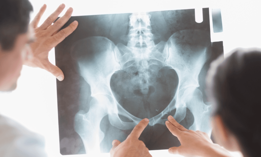 Uro-TAC / TAC Urográfica